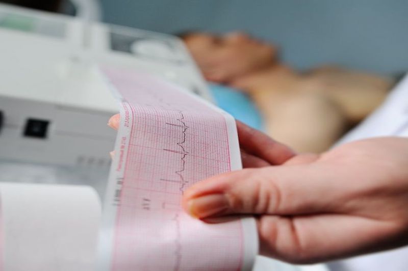 Electrocardiograma, Holter de Ritmo, Holter de presión
